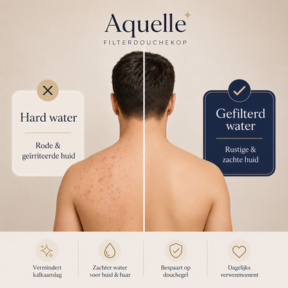 Aquelle Filterdouchekop | Zachter Water Voor Huid en Haar