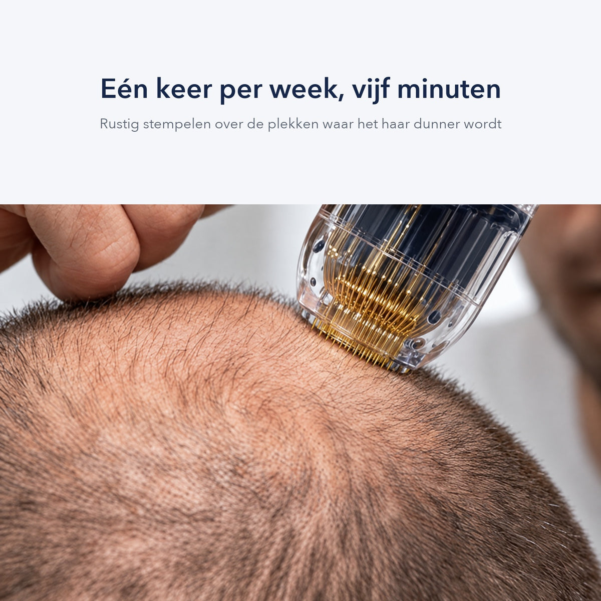 De applicator wordt rustig op de hoofdhuid gestempeld