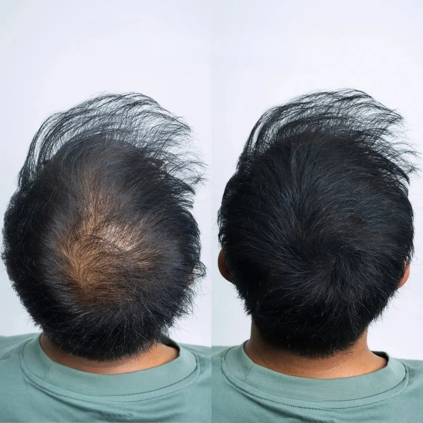RootLift Pro- Camouflerend haarpoeder UNISEX