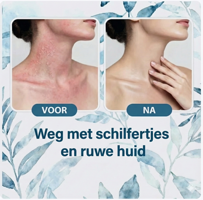 Verum Herba | Crème tegen jeuk, roodheid & irritatie